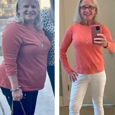 OPTAVIA weight loss before after